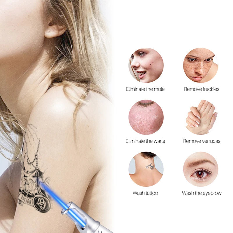 Smart Tattoo Removal Laser Pen | At-Home Professional Skin Renewal Device