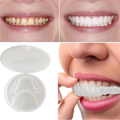 WhiteSmile Pro | Instant Dental Veneer for a Perfect Smile
