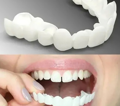 SmileFit | Instant Removable Veneers for a Perfect Smile