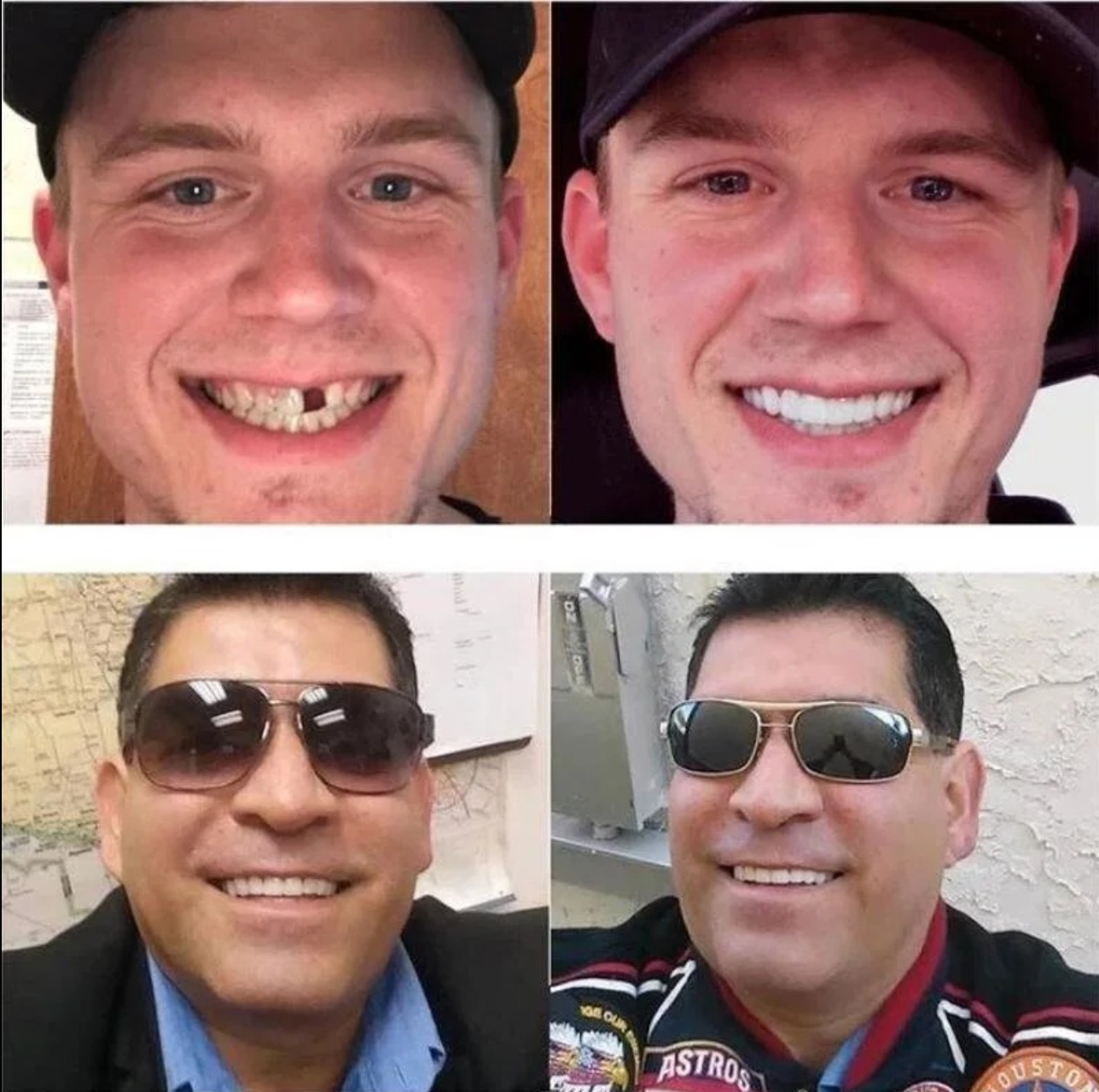 SmileFit | Instant Removable Veneers for a Perfect Smile